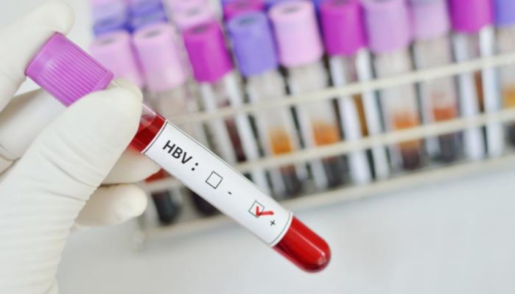 analizele pentu depistarea hepatitei virale b