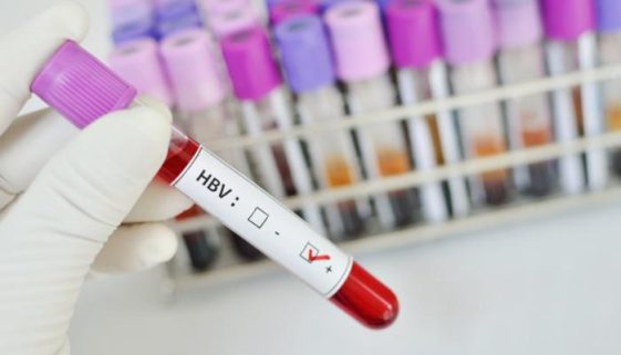 analizele pentu depistarea hepatitei virale b