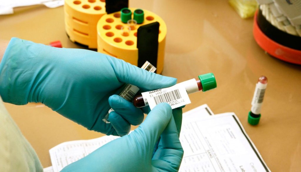 cum ne pregatim pentru analizele medicale